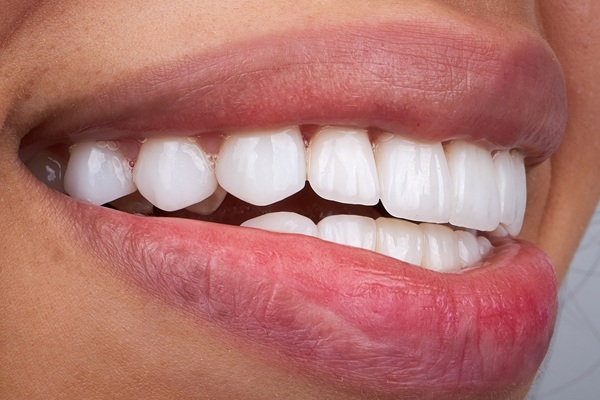 Why Dental Bridges Are An Effective Tooth Restoration