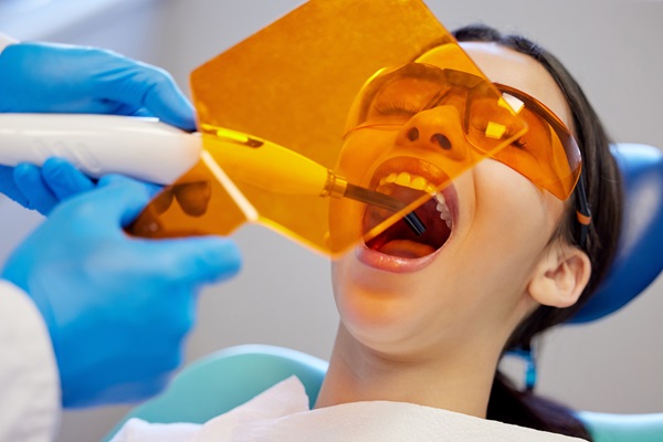 The Difference Between Dental Inlays And Dental Fillings