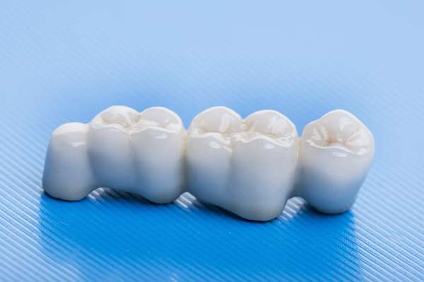 How Many Teeth Can Dental Bridges Replace from Alameda Dental in Aurora, CO