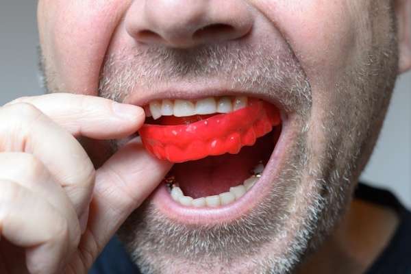 Save Your Teeth by Wearing Mouth Guards at Night from Alameda Dental in Aurora, CO
