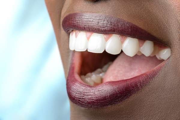Routine Dental Care: What Are Tooth Colored Fillings from Alameda Dental in Aurora, CO
